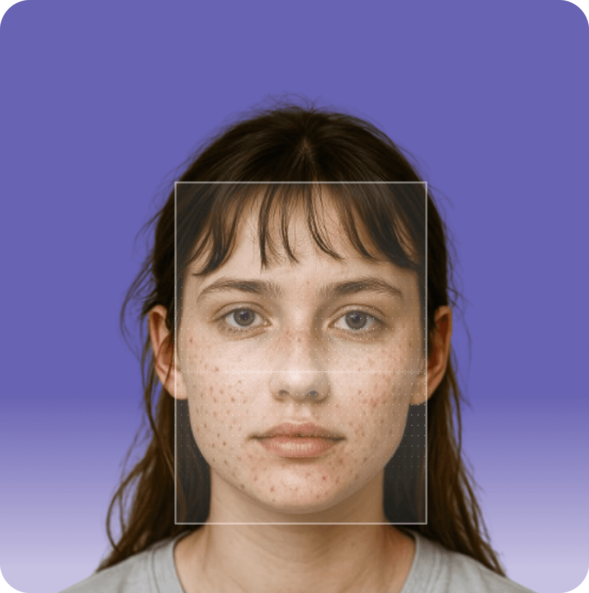 AI Skin Analysis